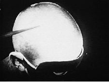 Mechanics of the Brain