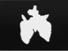 Il n'y a rien de plus inutile qu'un organe