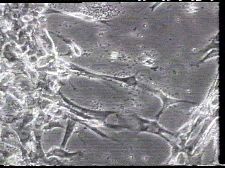 Des gouttes de jalousie