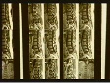 Benim bütün kabuslarim