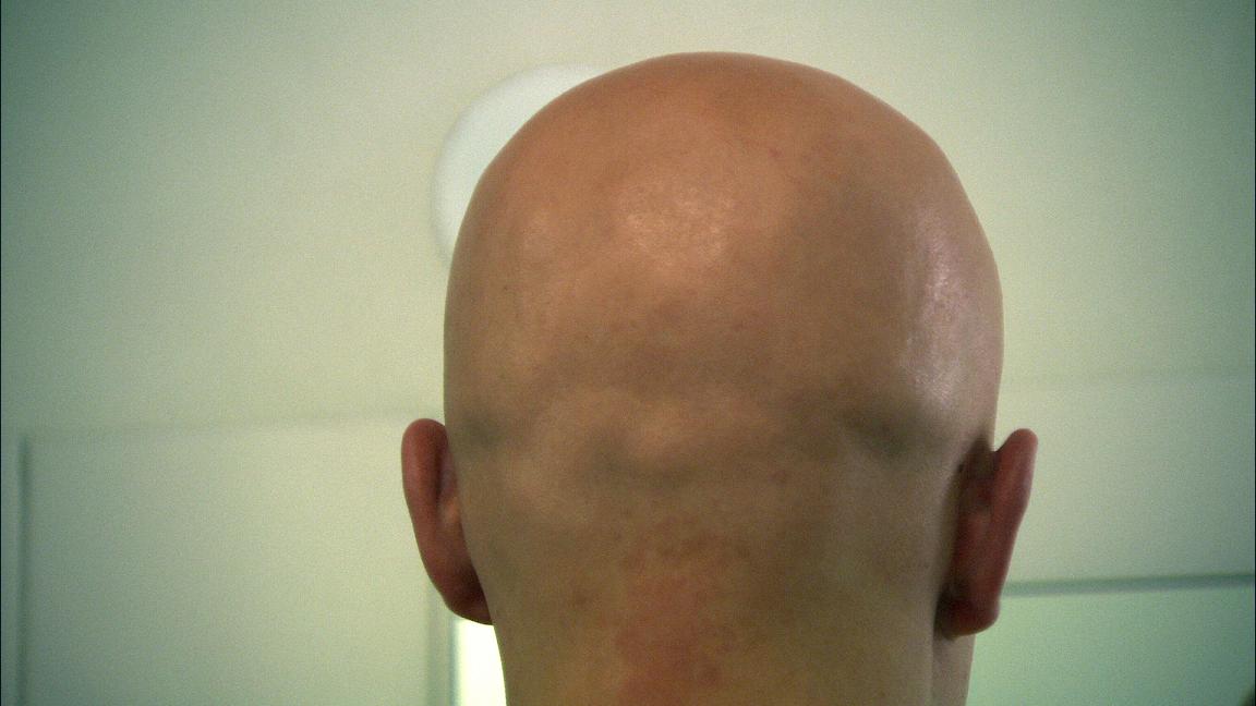 Haar