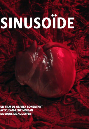 Sinusoïde