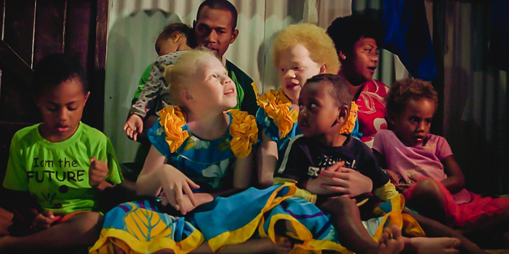 Coming out of the Shadows - Albinism in Fiji