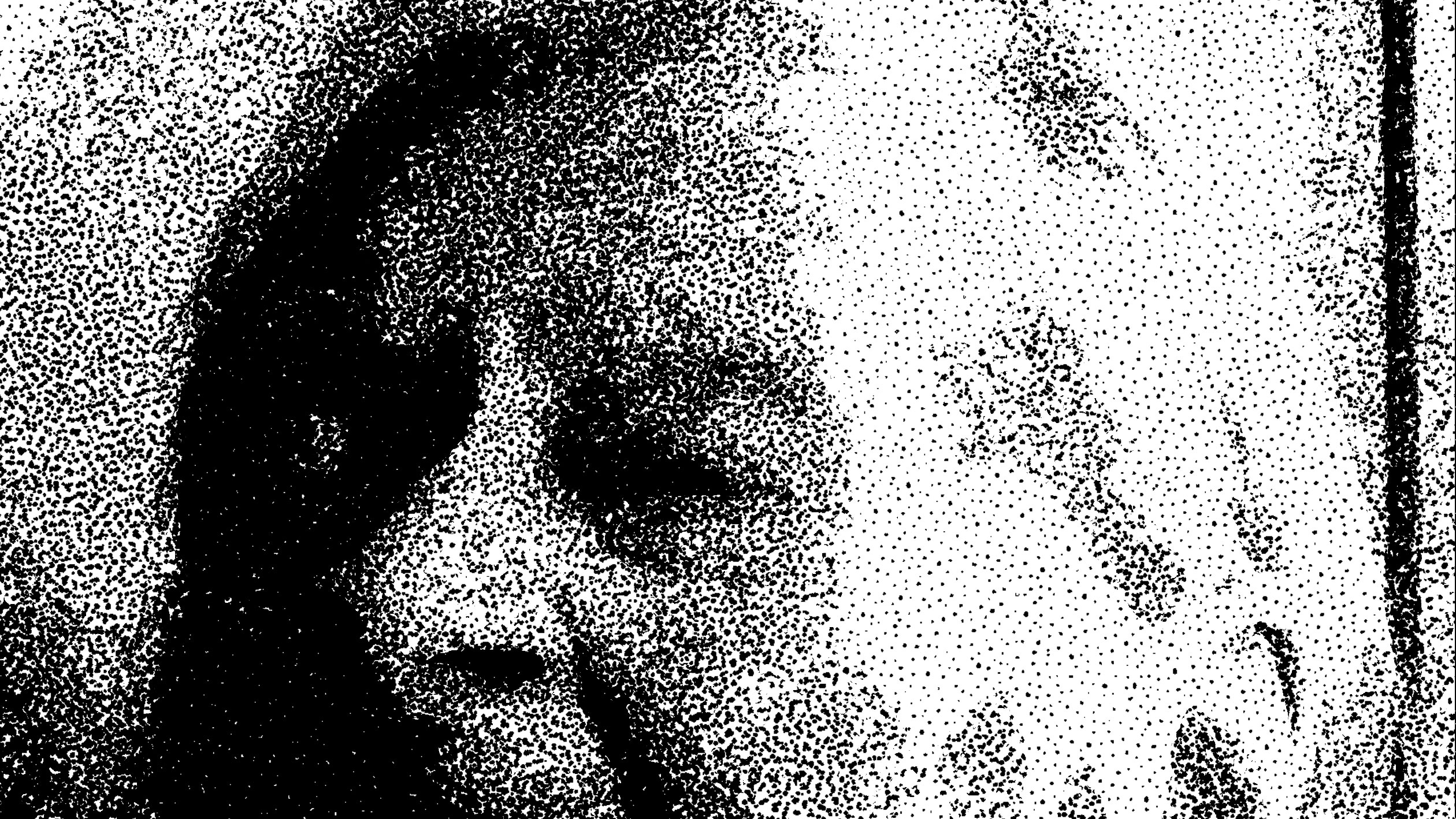 Dancing Lady In A Wheel-Chair