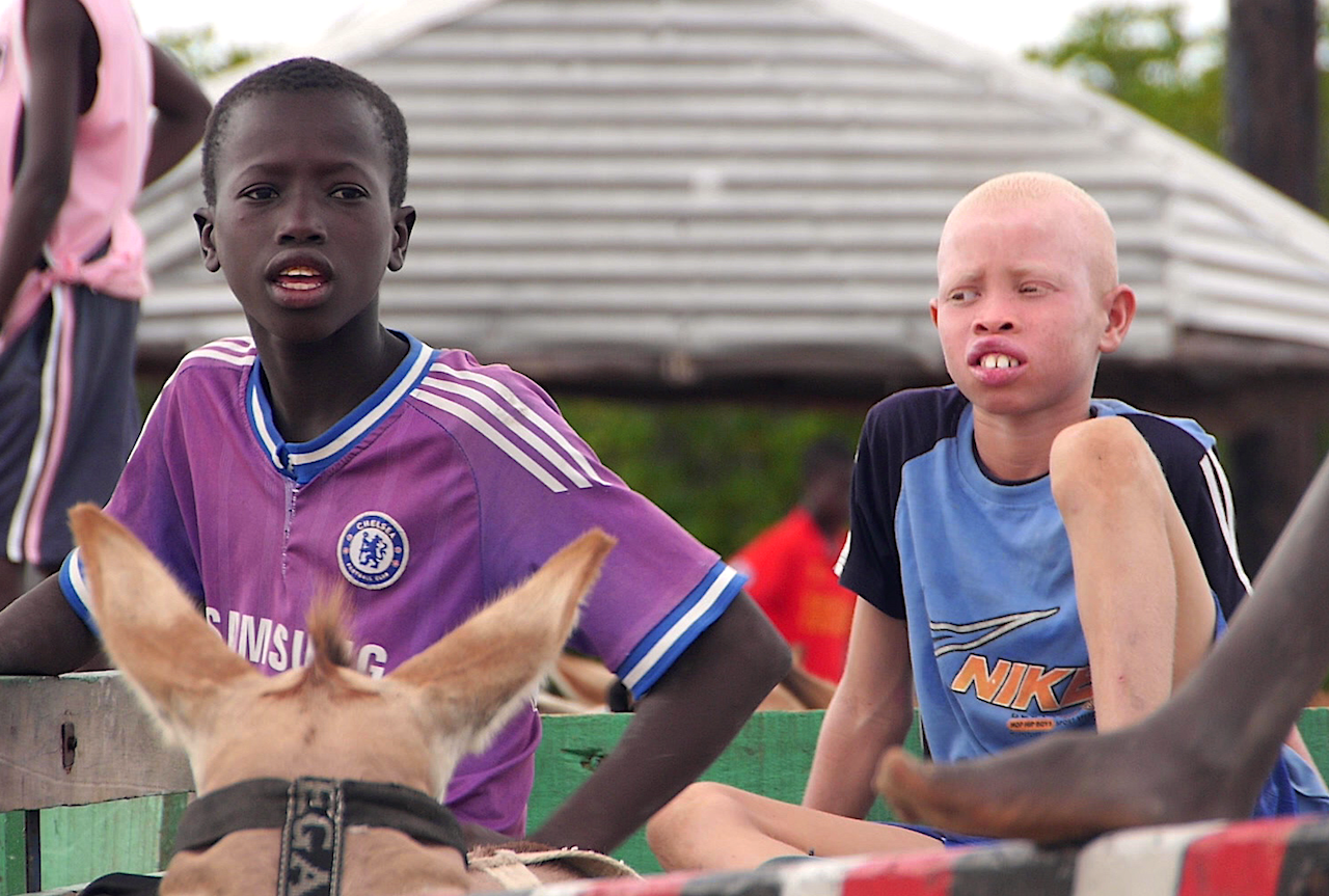 Albinos à Bassoul