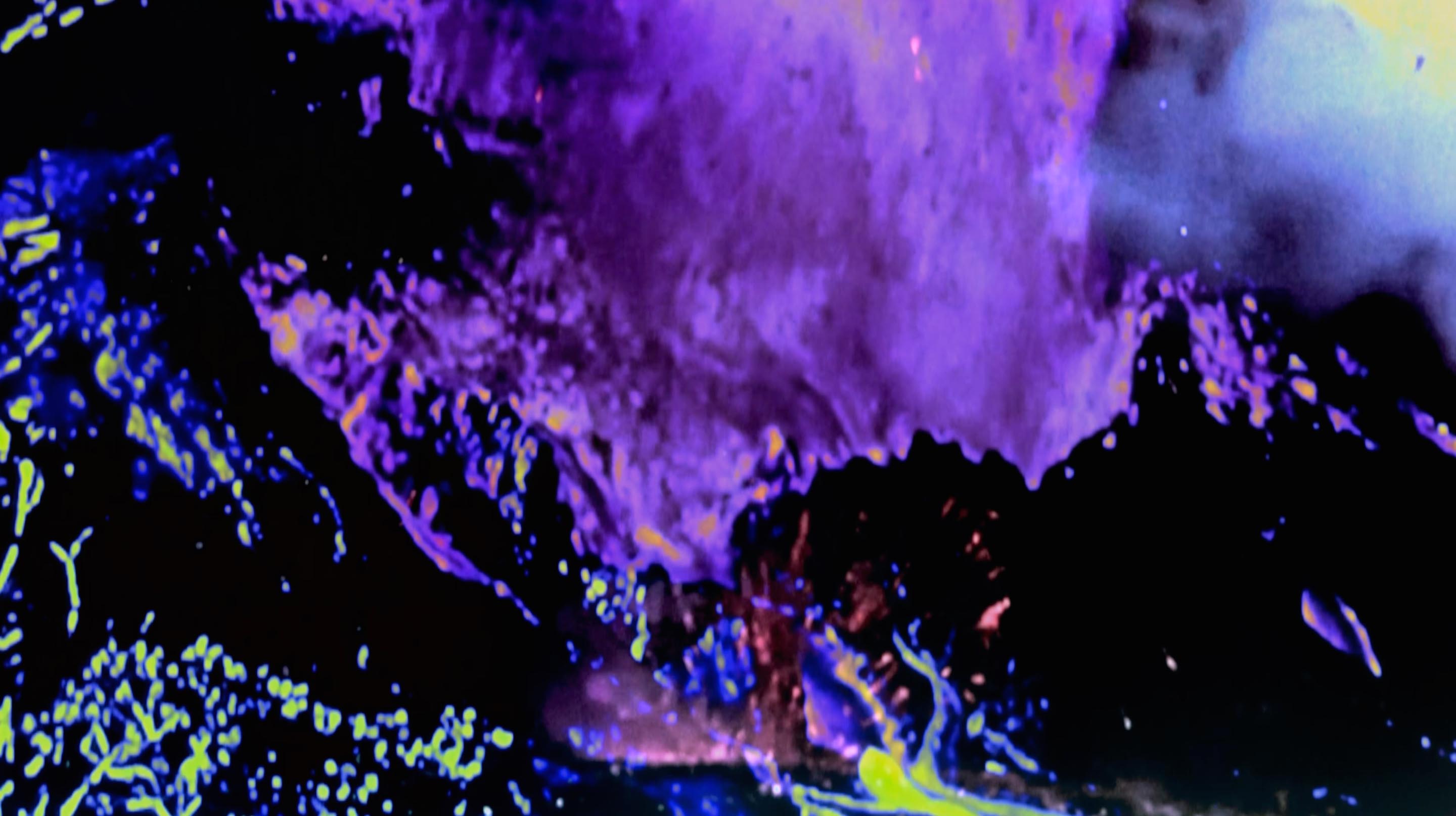 Hypnagogia