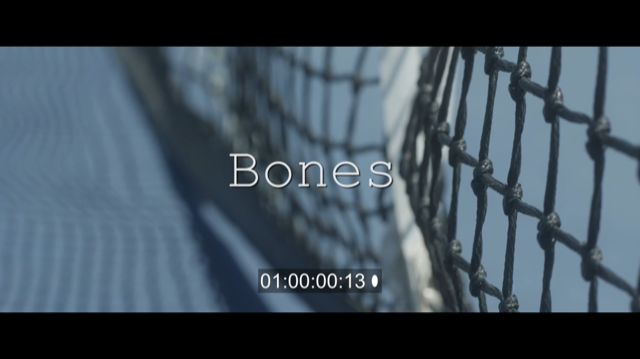 Bones