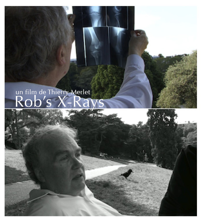 Rob's X-Rays