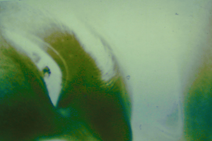 Visit