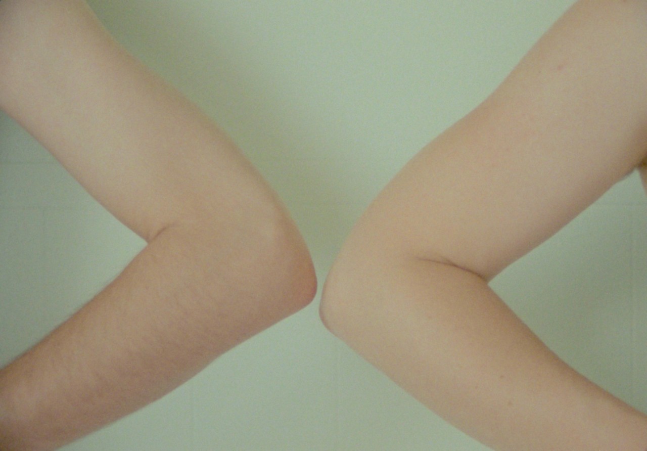 Special Dark Glass Somewhere