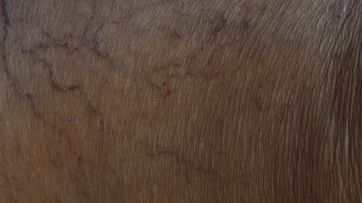 susurro de las hojas