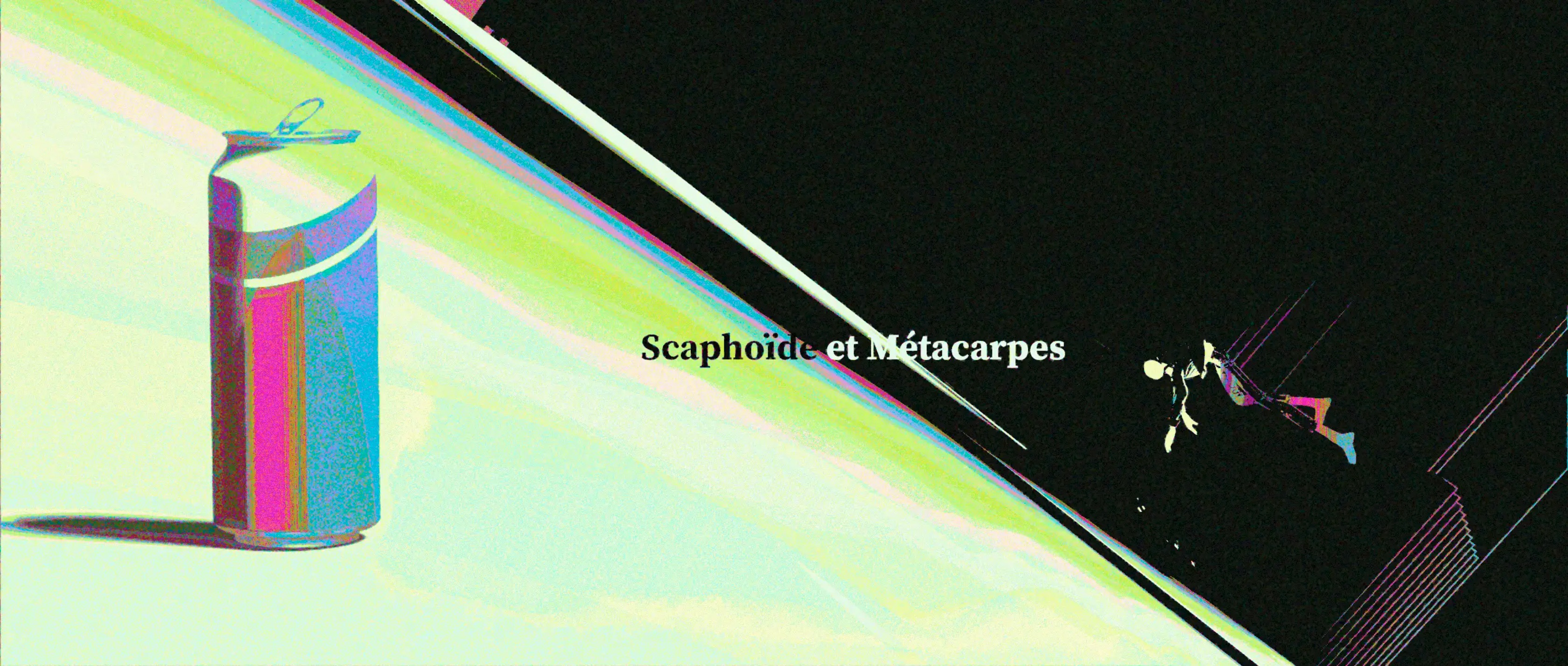 Scaphoîde et métacarpes