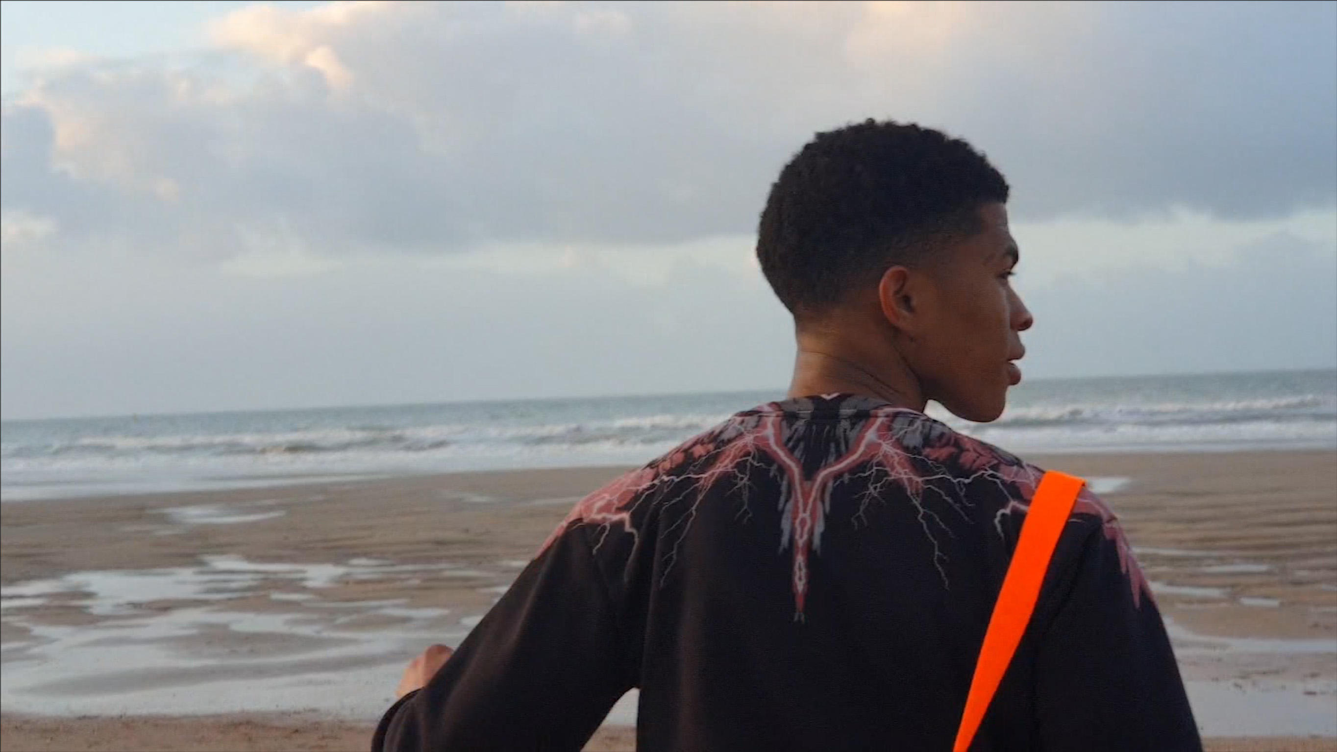 Roi du monde (fire wound)