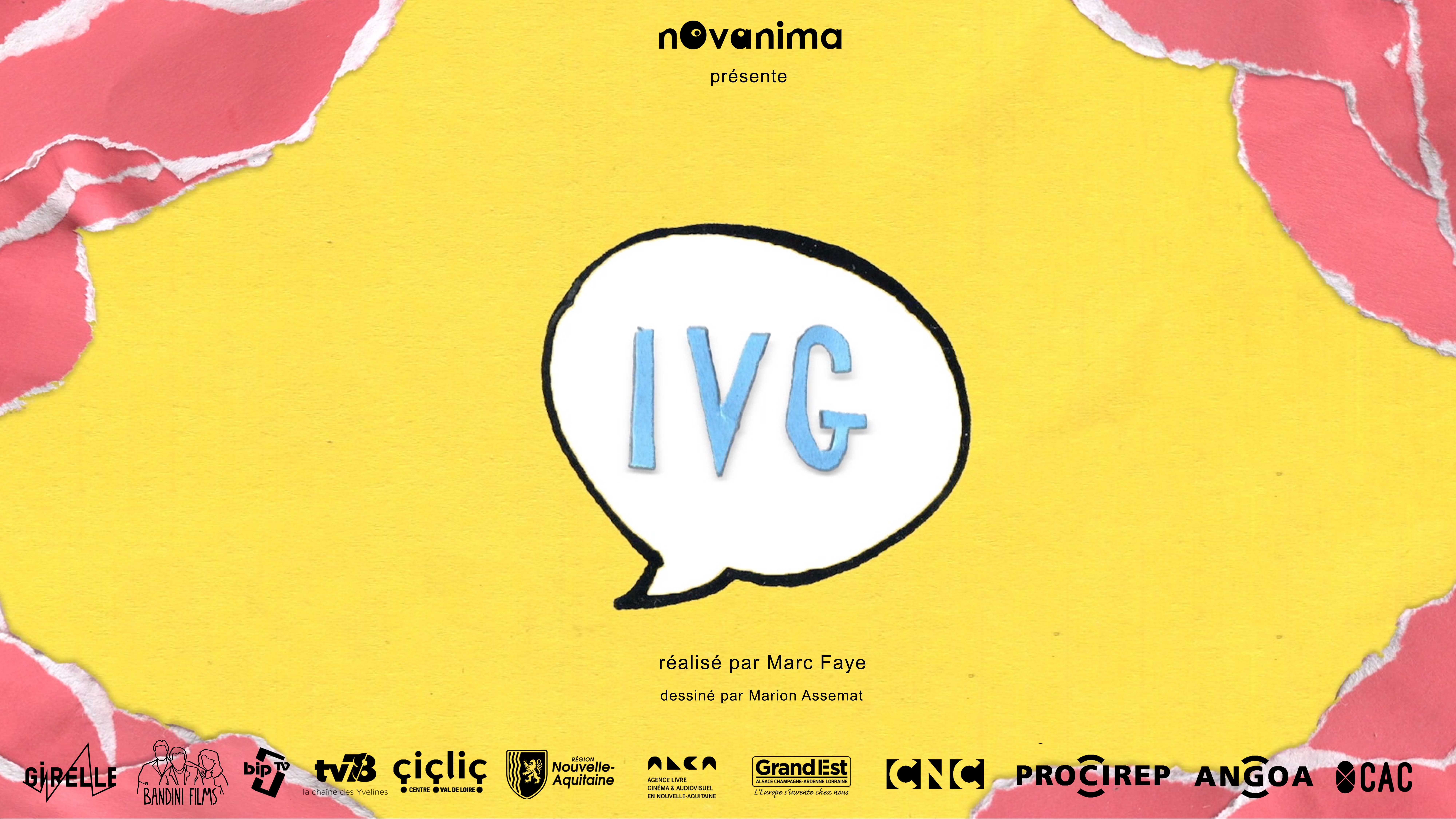 IVG