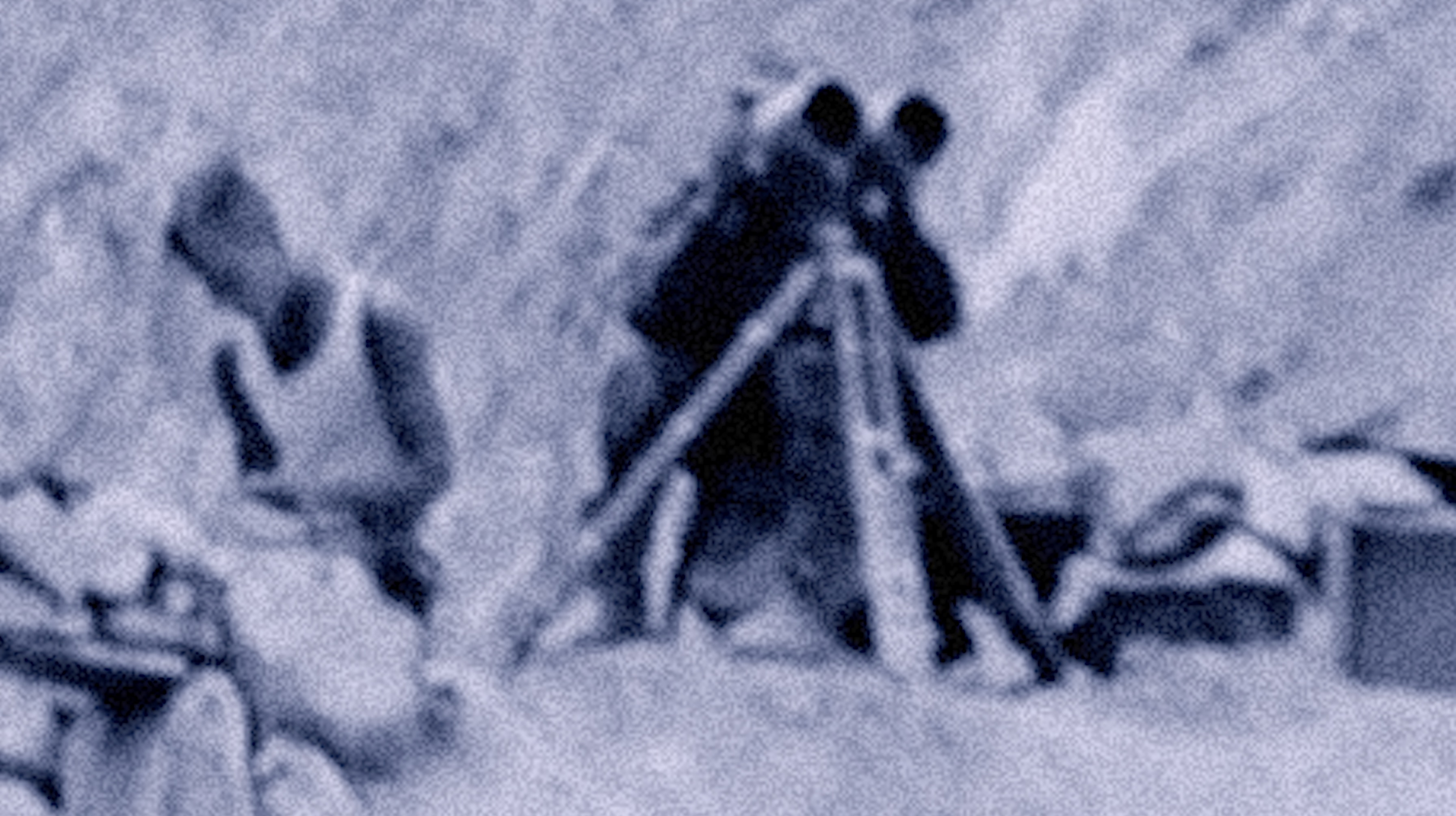 Mountain Sickness of the Russian Border Guard