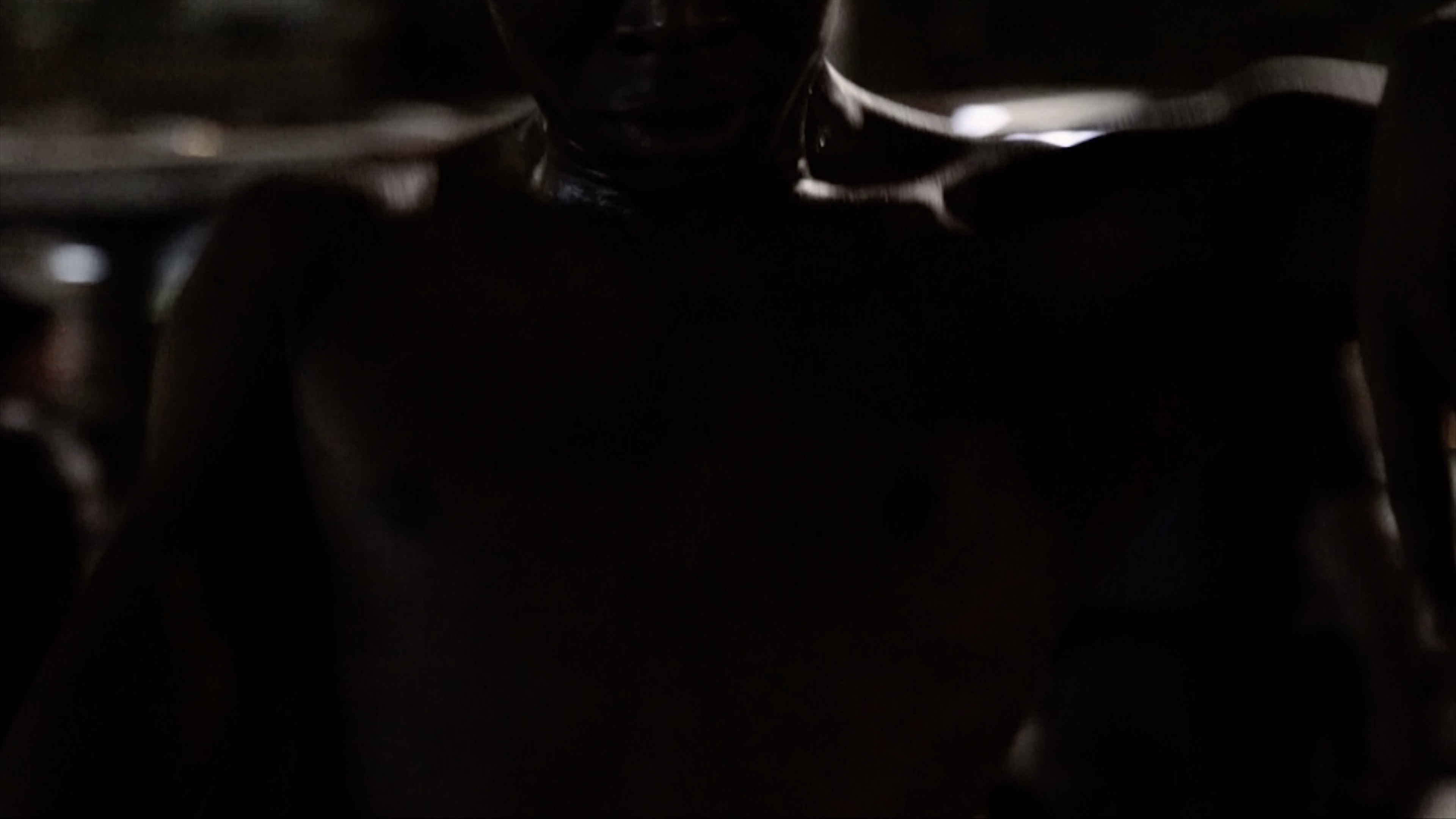 São Paulo Open Wound