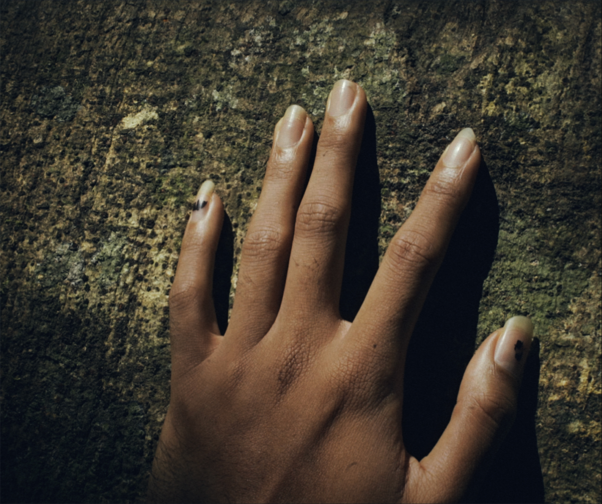 Strip of Eyelid Finds Its Morning