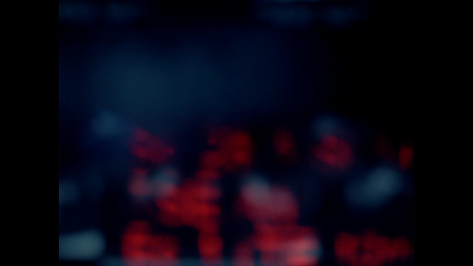 RMI o Resonancia magnética