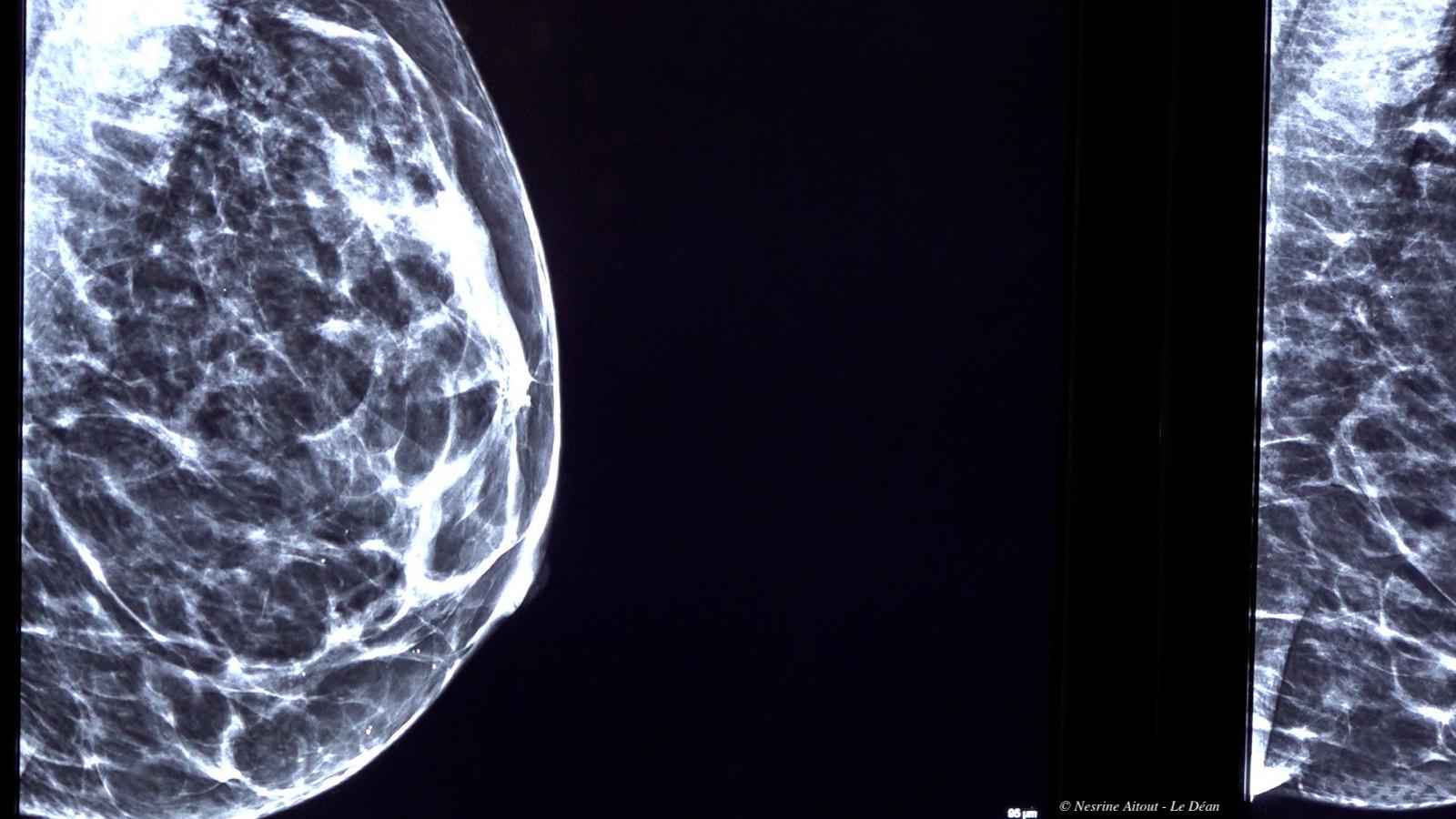 On est toutes pareilles