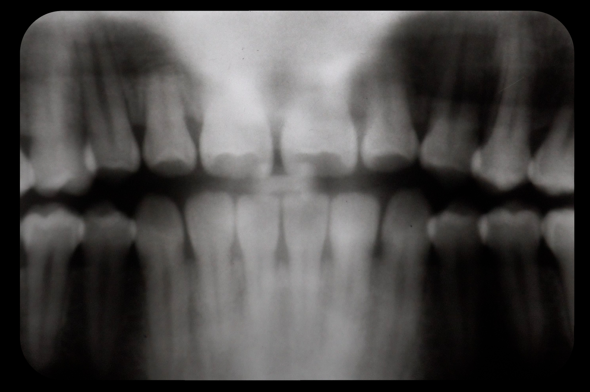 MAPA DENTAL