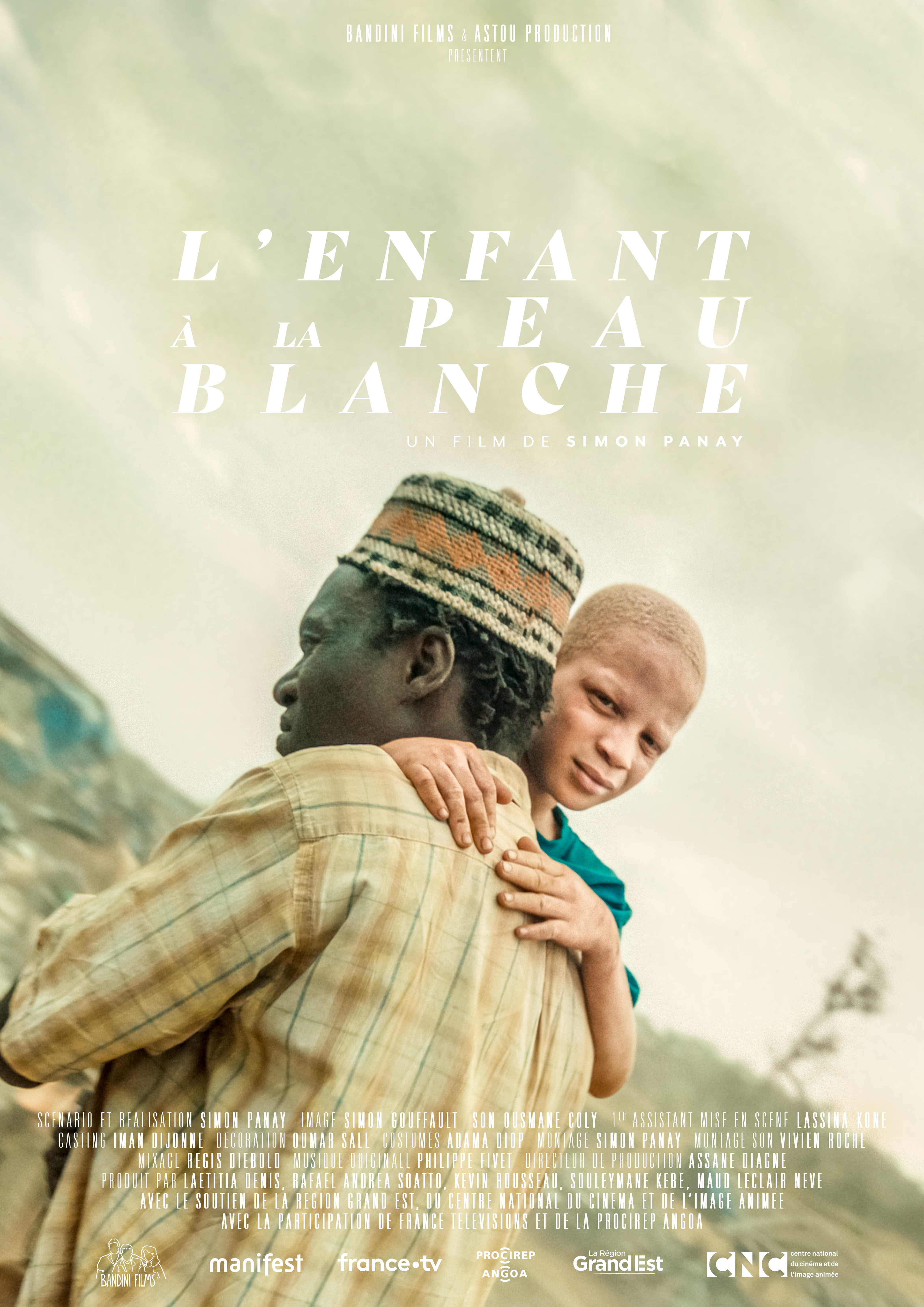 Enfant à la peau blanche
