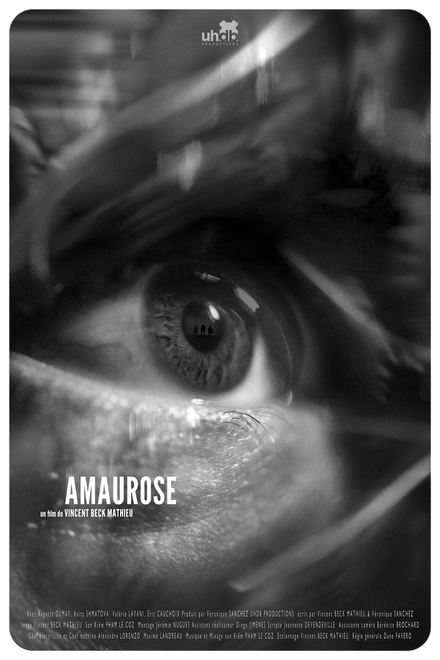 Amaurose